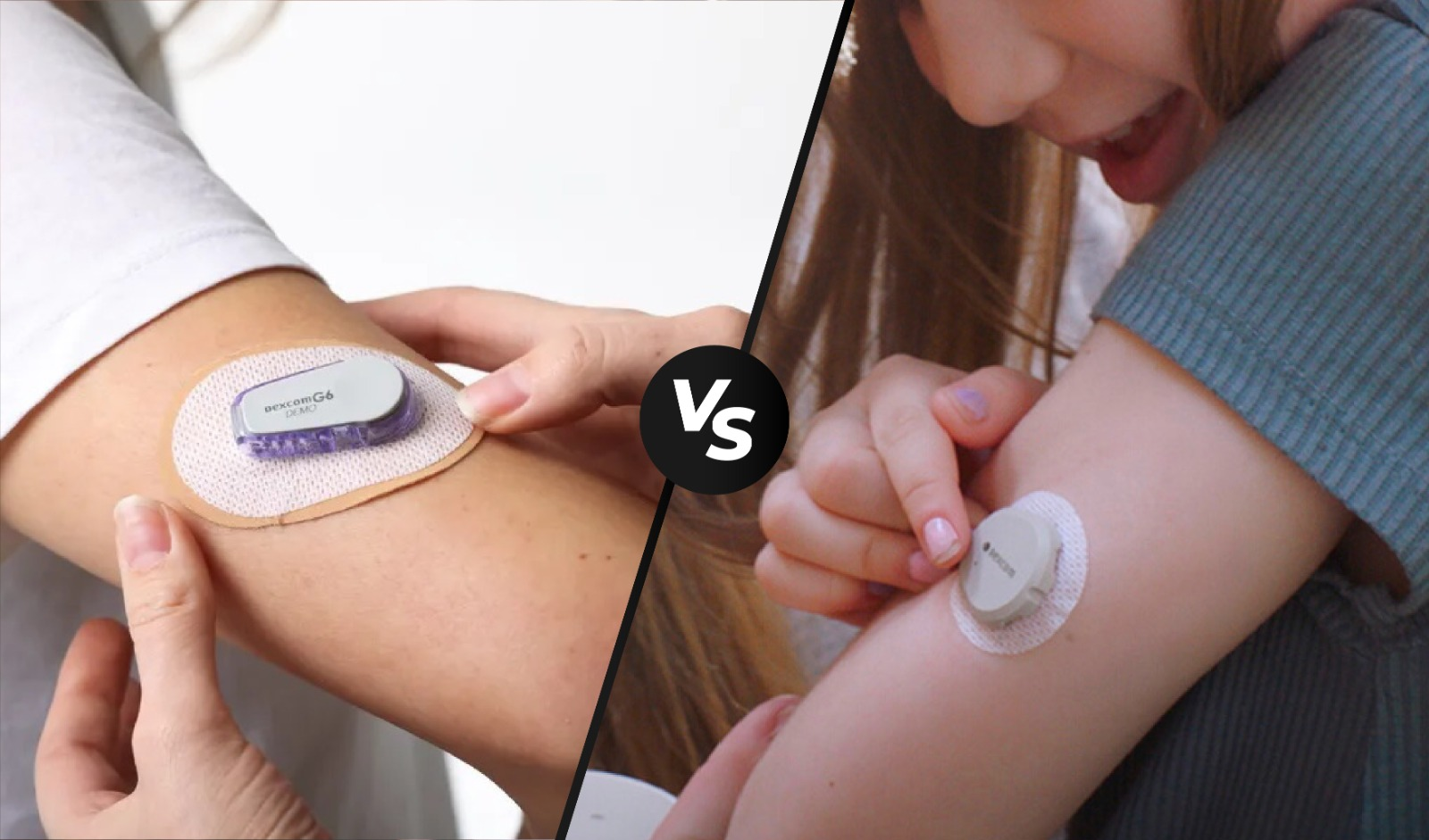 Dexcom G6 vs G7: Key Differences Explained